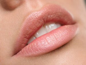 Read more about the article Redefine Your Smile with Lip Reduction