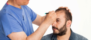Read more about the article Restore Hair Density with FUE Hair Transplant