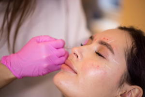 Read more about the article Top Reasons People Choose Exosome Therapy