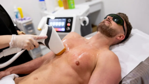 Read more about the article What Results from Men’s Laser Hair Removal?