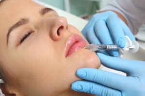 Read more about the article What to Expect from Juvederm Treatment