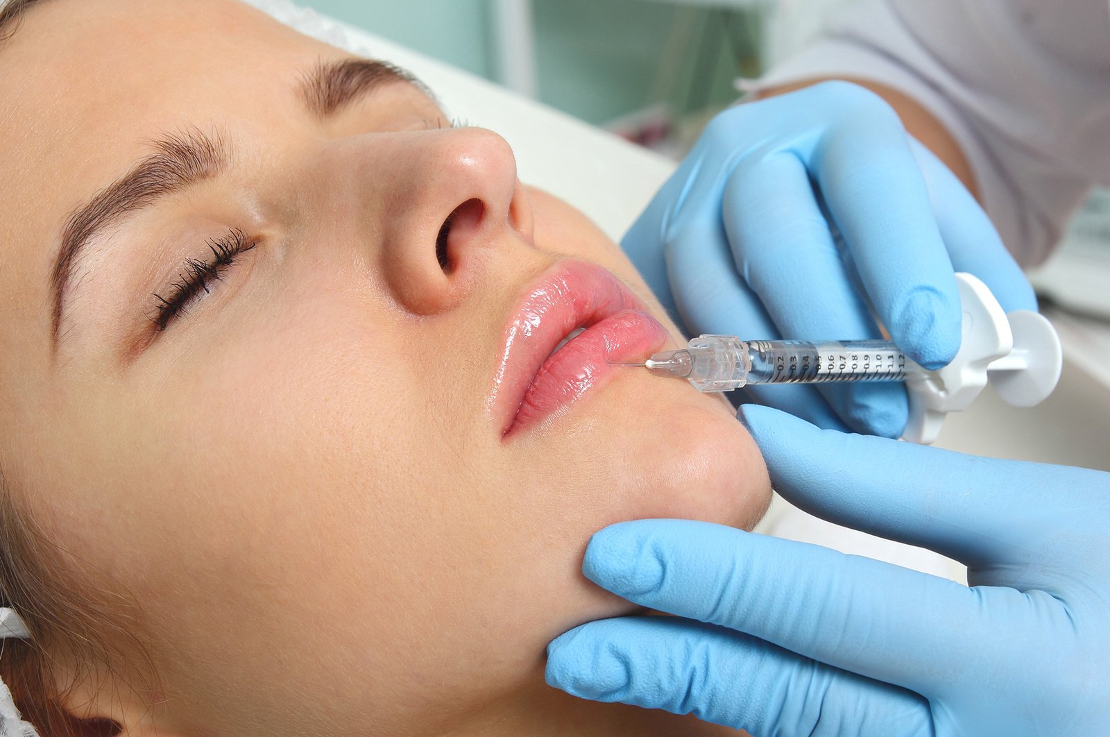 You are currently viewing What to Expect from Juvederm Treatment