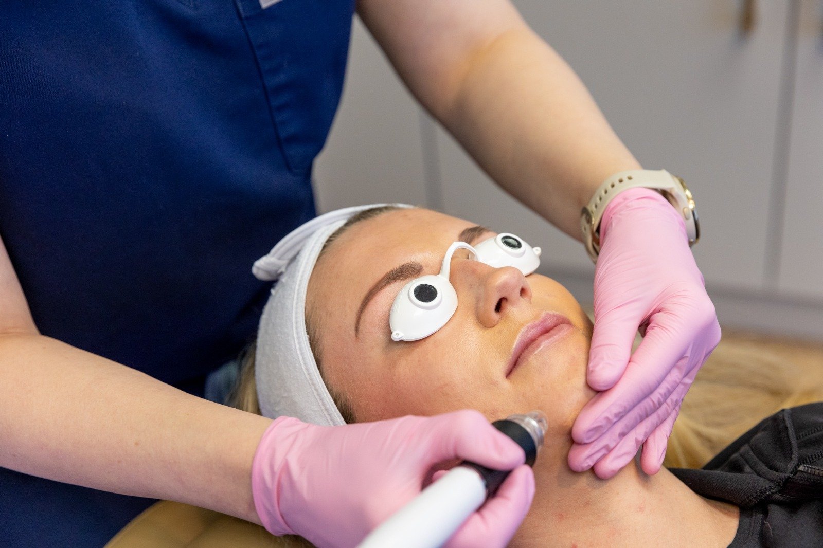 You are currently viewing Transform Your Skin with SkinPen Microneedling