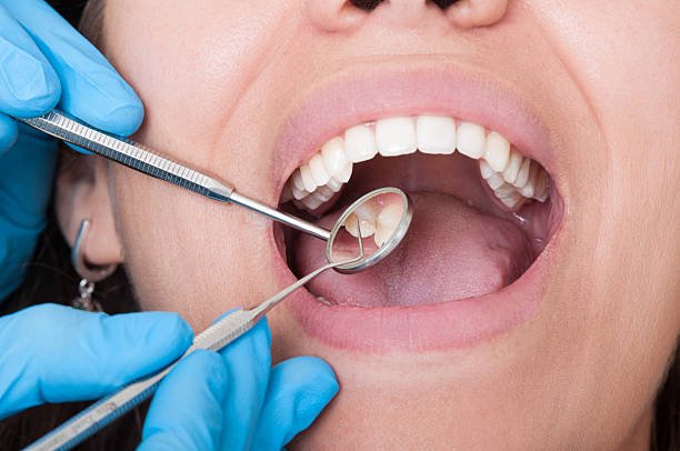 You are currently viewing Why Do Wisdom Teeth and Missing Teeth Change Everything Today?