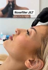 You are currently viewing Paradeplatz Botox – Wenn Präzision auf Ausdruck trifft