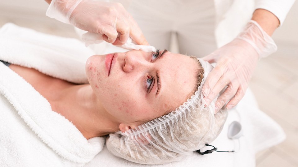 You are currently viewing Does Pimple Treatment Prevent Breakouts?