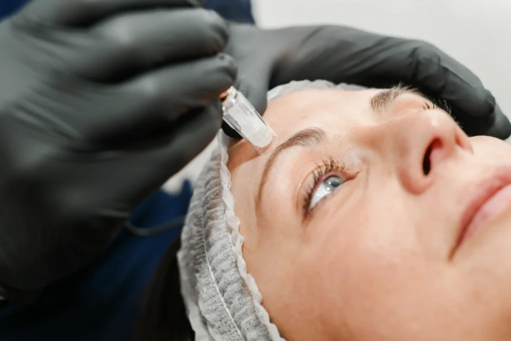 You are currently viewing How Effective Is Microneedling for Wrinkles?