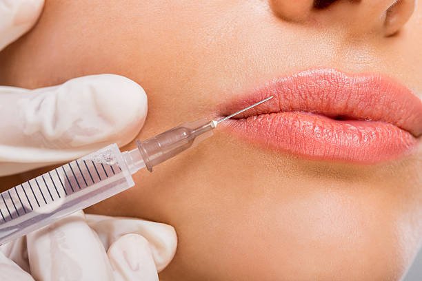 You are currently viewing How Many Sessions for Russian Lip Fillers ?