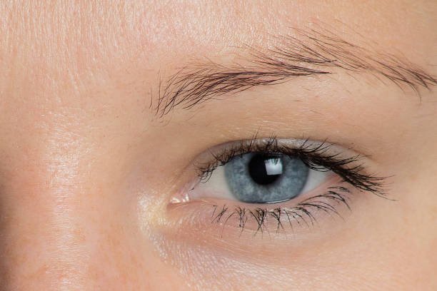 You are currently viewing Is Eyelid Surgery Effective for Puffy Eyes?
