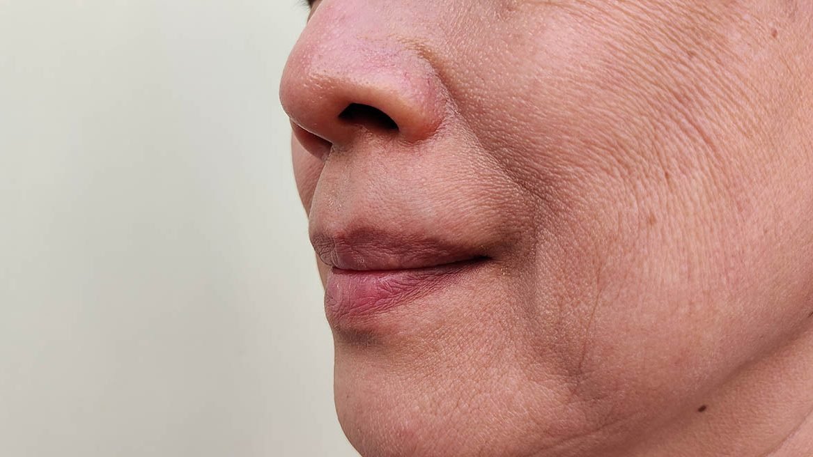 You are currently viewing What Age Is Best for Anti-aging Treatments?